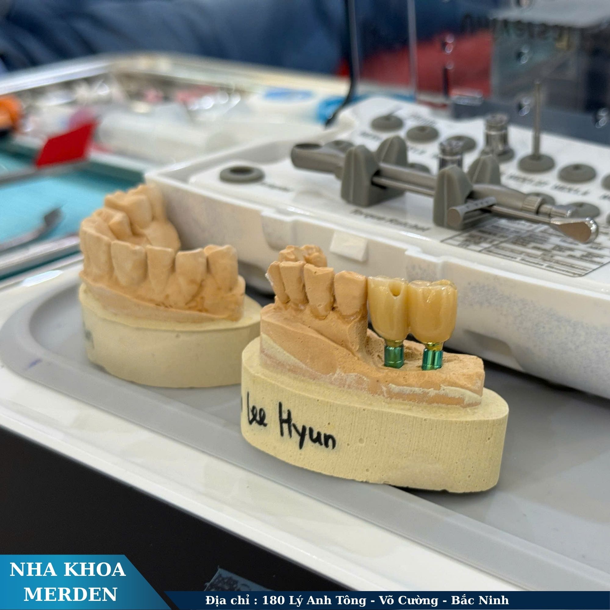 Làm thế nào để biết nha khoa uy tín?