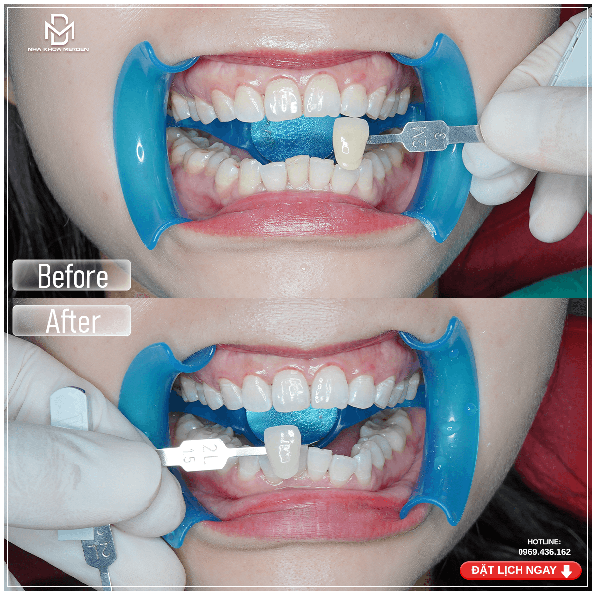 TẨy Trawsnhg 2510