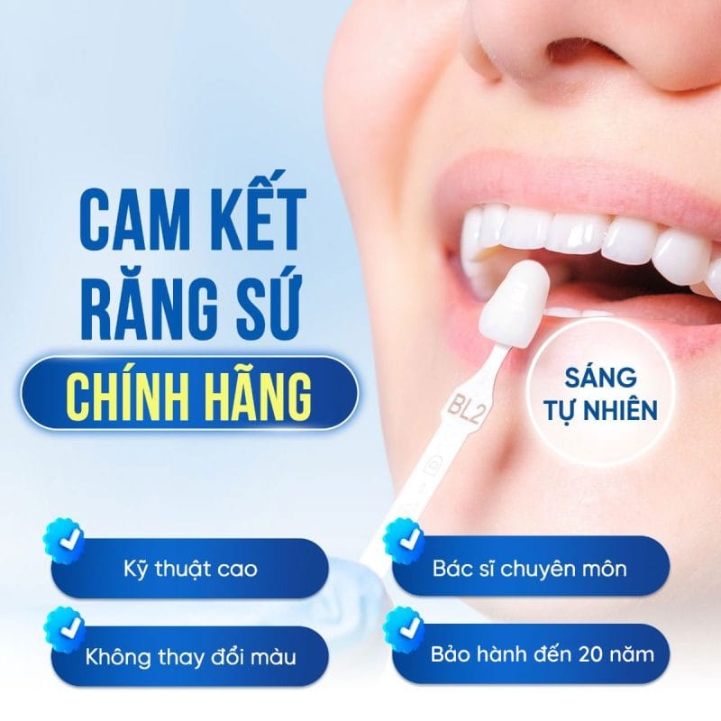 Răng Sứ