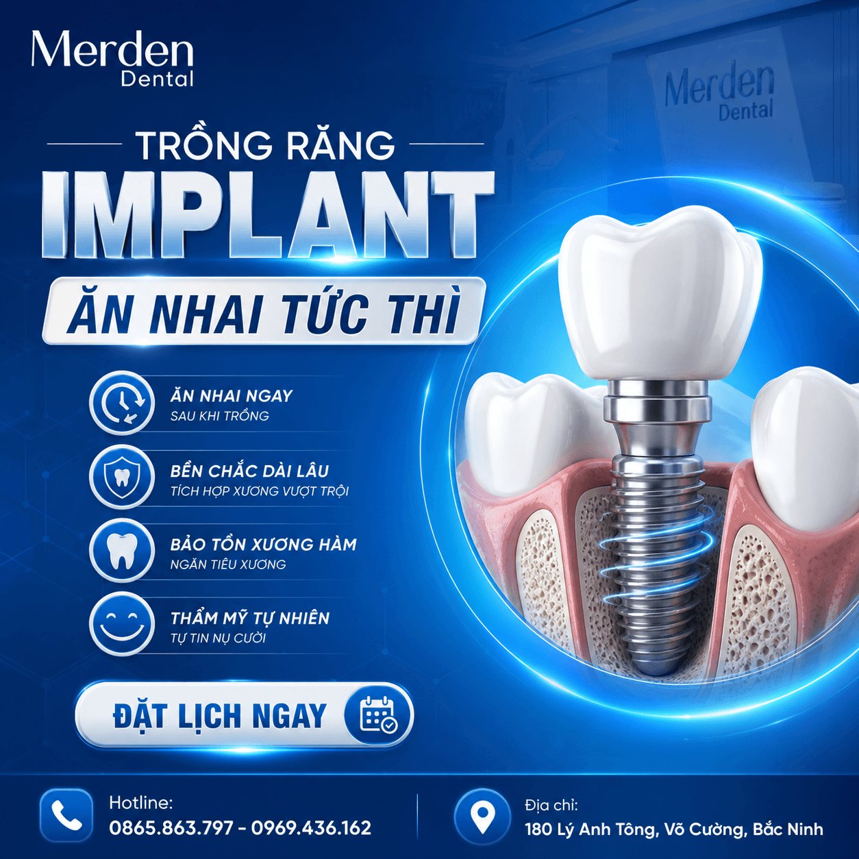 Implant